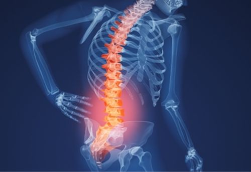 5 bài thuốc trị đau lưng